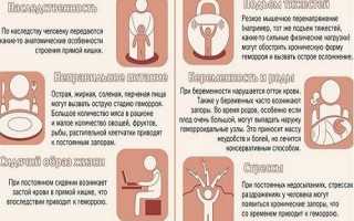 При геморрое болит низ живота, что делать?