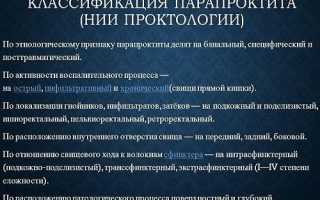 Классификация парапроктита: коды по МКБ