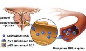 Зачем нужен анализ крови на ПСА для диагностики заболеваний