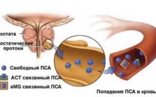 Зачем нужен анализ крови на ПСА для диагностики заболеваний
