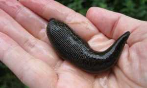 Эффективность гирудотерапии при геморрое: помогут ли пиявки победить заболевание?