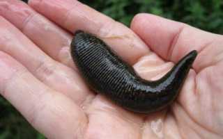 Эффективность гирудотерапии при геморрое: помогут ли пиявки победить заболевание?