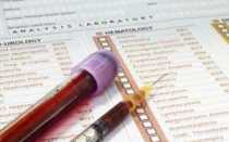 Что такое анализ крови на МНО и его значение