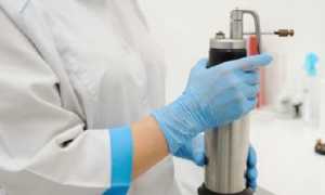 Как проводится криотерапия геморроидальных узлов?