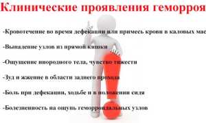 Наружный геморрой: причины, симптомы и лечение