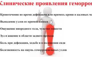 Наружный геморрой: причины, симптомы и лечение