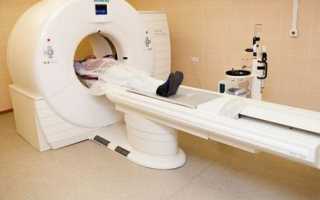 Что такое виртуальная колоноскопия, как проводится КТ колонография?