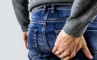 От чего появляется геморрой у мужчин и как можно его вылечить?