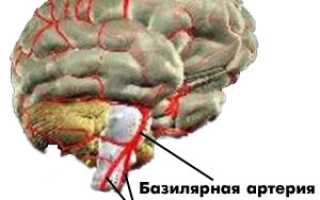 Что такое вертебро-базилярная недостаточность и её последствия