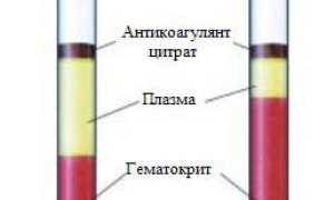Что означает высокий гематокрит и его влияние на здоровье