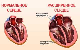 Большое сердце — символ любви и доброты