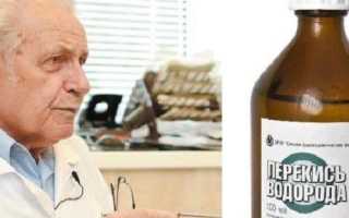 Лечение геморроя по Неумывакину: методы профессора при помощи соды и перекиси водорода