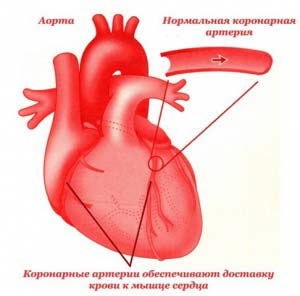 коронарные артерии