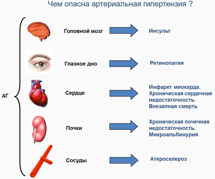 чем опасна артериальная гипертензия