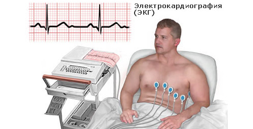 процедура ЭКГ