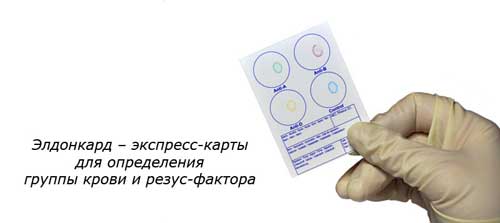 Элдонкард