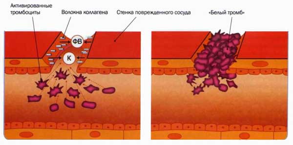 формирование тромбов