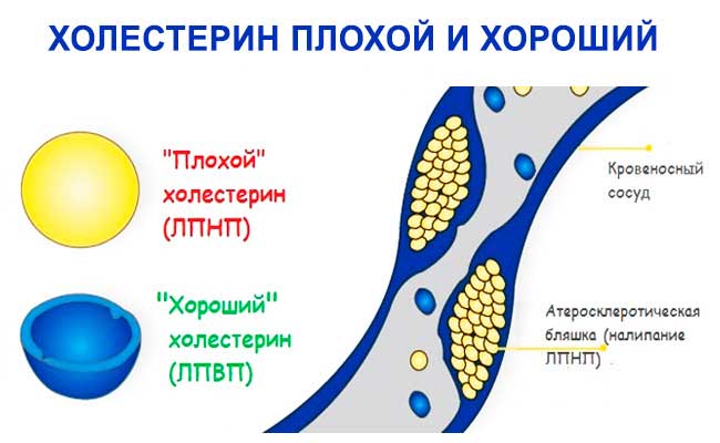 виды холестерина 