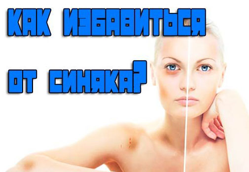 женщина с синяком