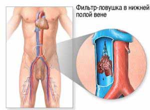 кава фильтр