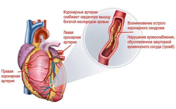 обследование коронарной артерии
