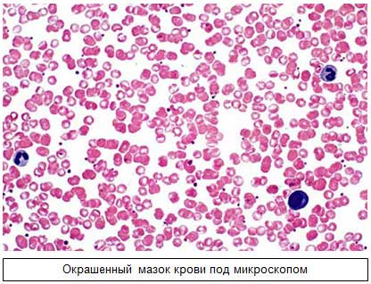 окрашенный мазок крови