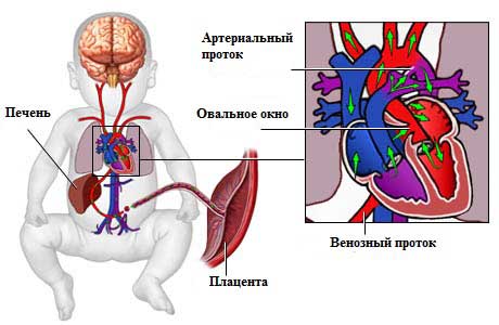 овальное окно у ребенка