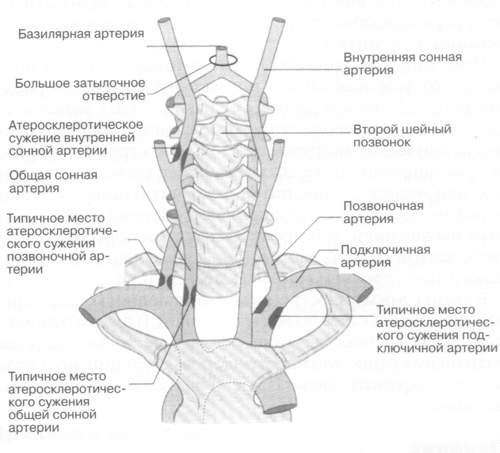 кровоток в позвоночнике