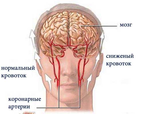 причины спазмов головного мозга