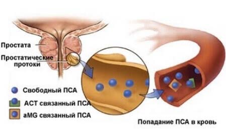 простата