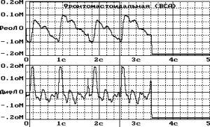 расшифровка колебаний