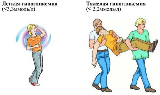 стадии гипогликемии
