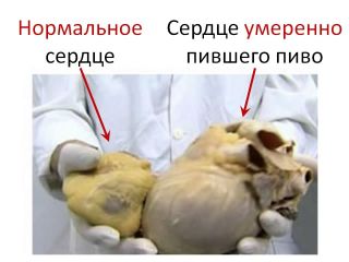 сердце алкоголика