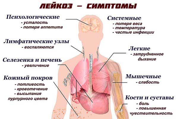 симптомы заболевания