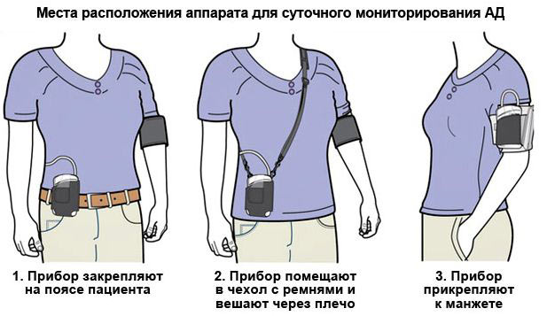 расположение СМАД