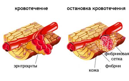 сосуд при кровотечении
