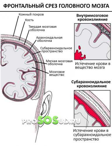 срез головного мозга