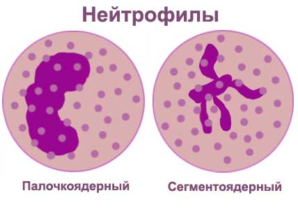 виды нейтрофилов
