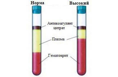 высокий гематокрит